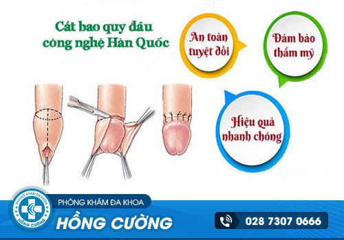 10 Địa chỉ cắt bao quy đầu Quận 5 không đau, giá rẻ, an toàn